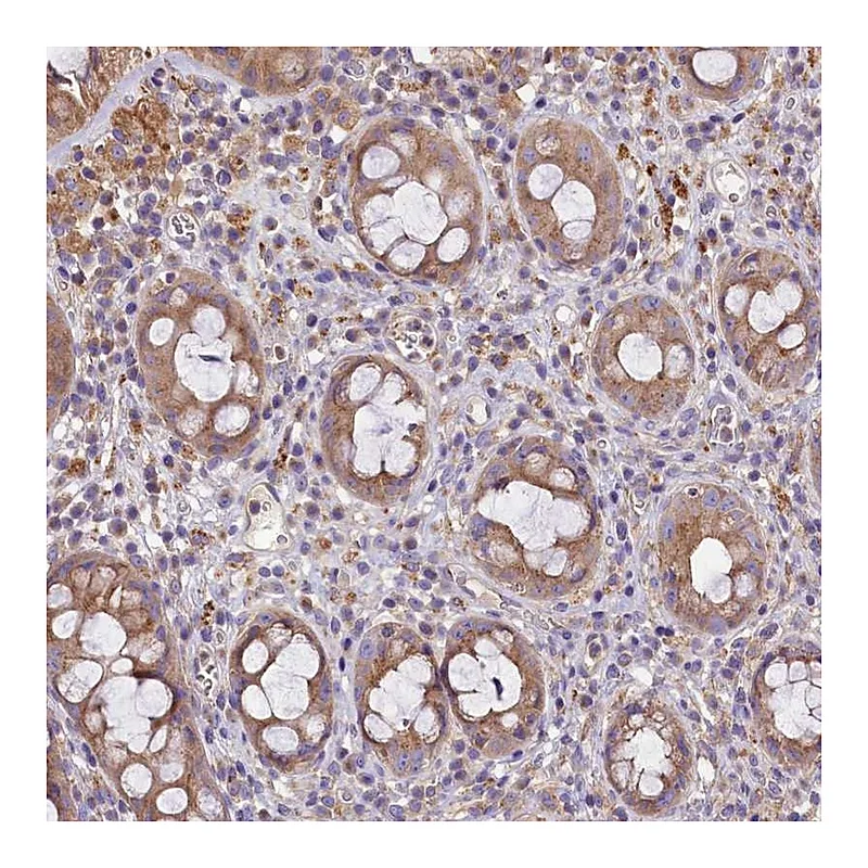 Atlas Antibodies Anti-PEMT Antibody