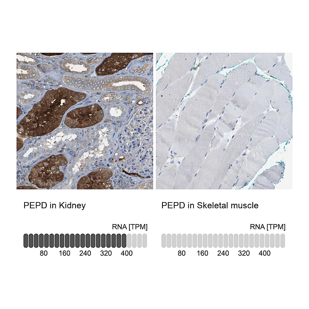 Atlas Antibodies Anti-PEPD Antibody