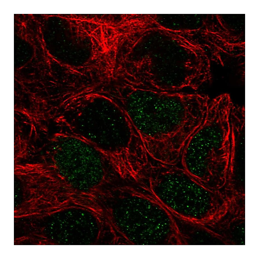 Atlas Antibodies Anti-PEPD Antibody