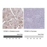 Atlas Antibodies Anti-PERM1 Antibody