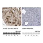 Atlas Antibodies Anti-PERM1 Antibody