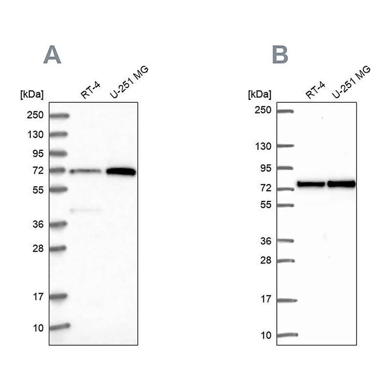 Atlas Antibodies Anti-PES1 Antibody