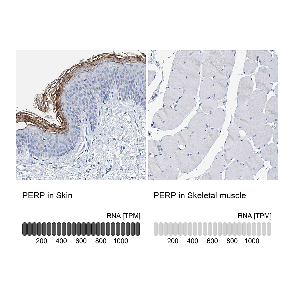 Atlas Antibodies Anti-PERP Antibody