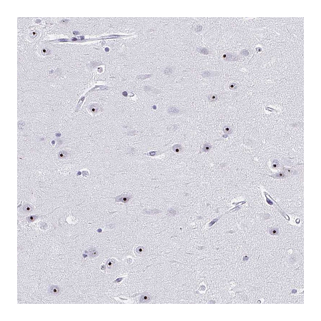 Atlas Antibodies Anti-PES1 Antibody
