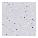Atlas Antibodies Anti-PES1 Antibody