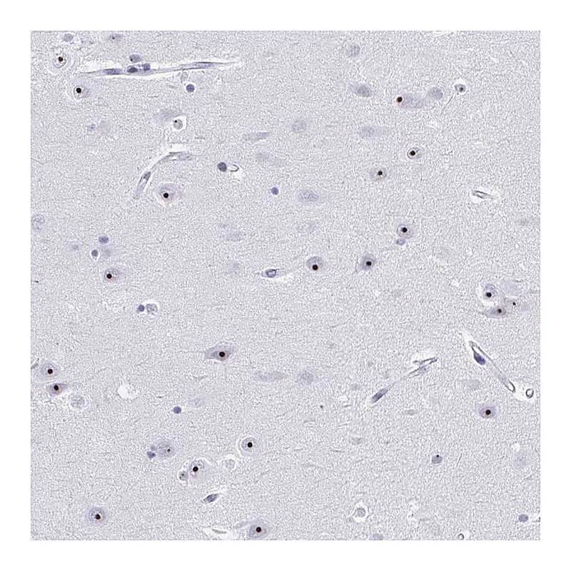 Atlas Antibodies Anti-PES1 Antibody