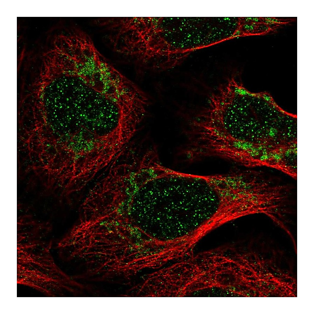 Atlas Antibodies Anti-PET100 Antibody