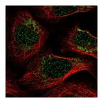 Atlas Antibodies Anti-PET100 Antibody