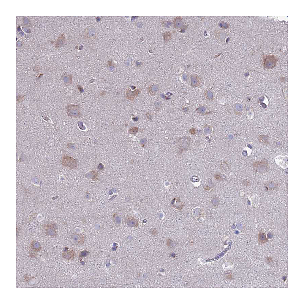 Atlas Antibodies Anti-PET117 Antibody