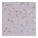 Atlas Antibodies Anti-PET117 Antibody