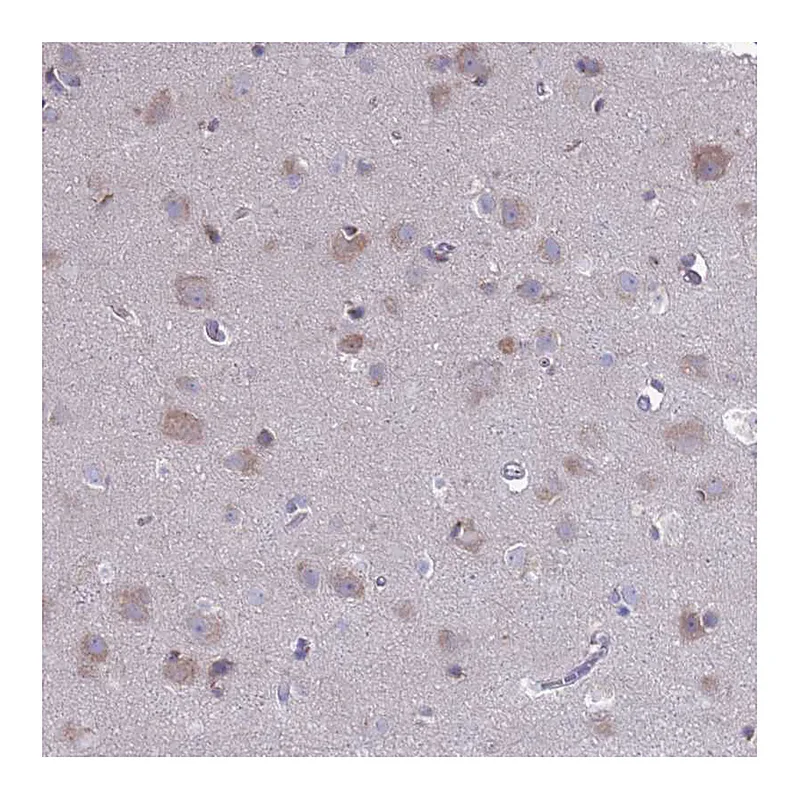 Atlas Antibodies Anti-PET117 Antibody