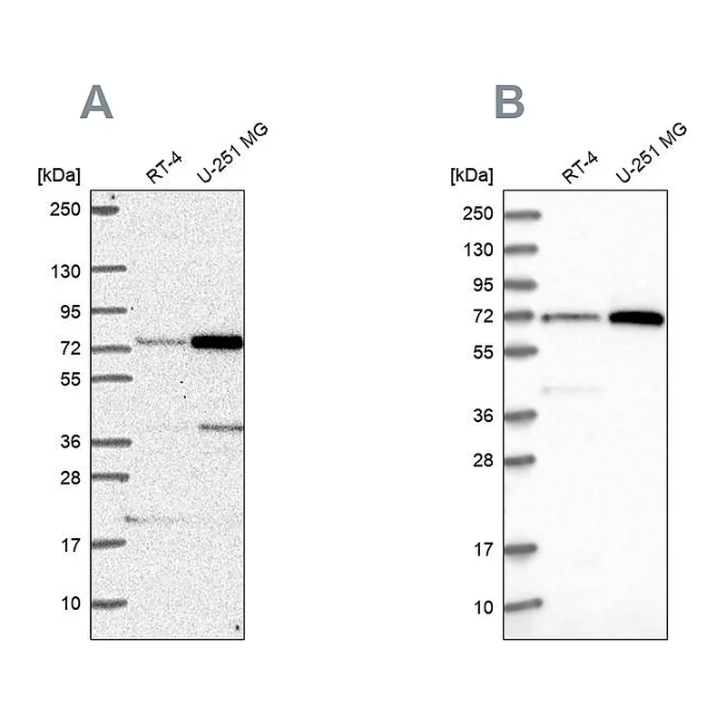 Atlas Antibodies Anti-PES1 Antibody