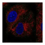 Atlas Antibodies Anti-PEX11B Antibody