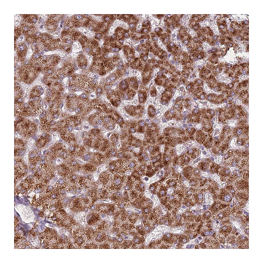 Atlas Antibodies Anti-PEX11B Antibody