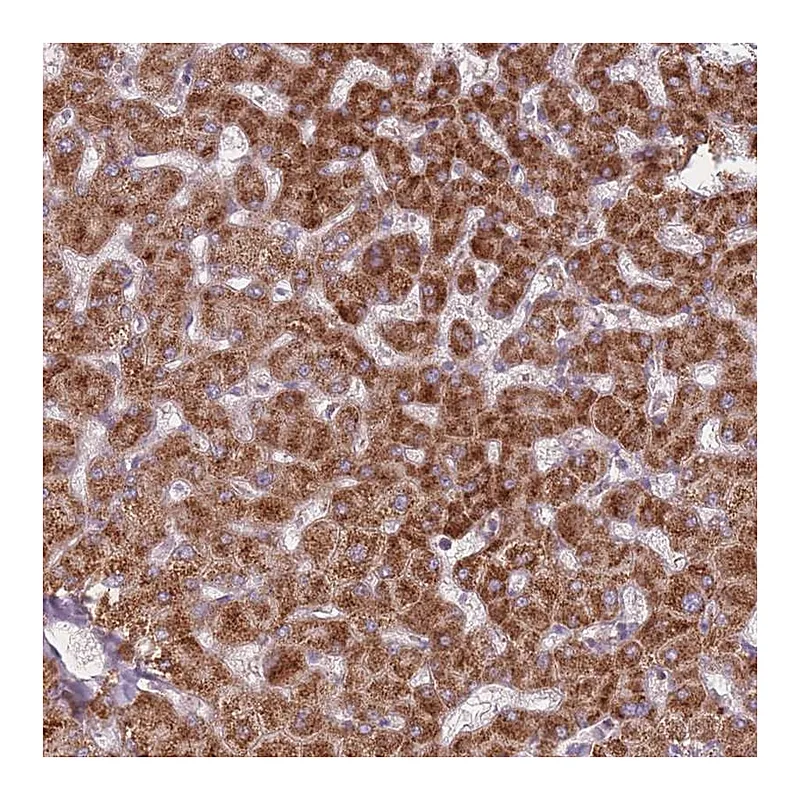 Atlas Antibodies Anti-PEX11B Antibody