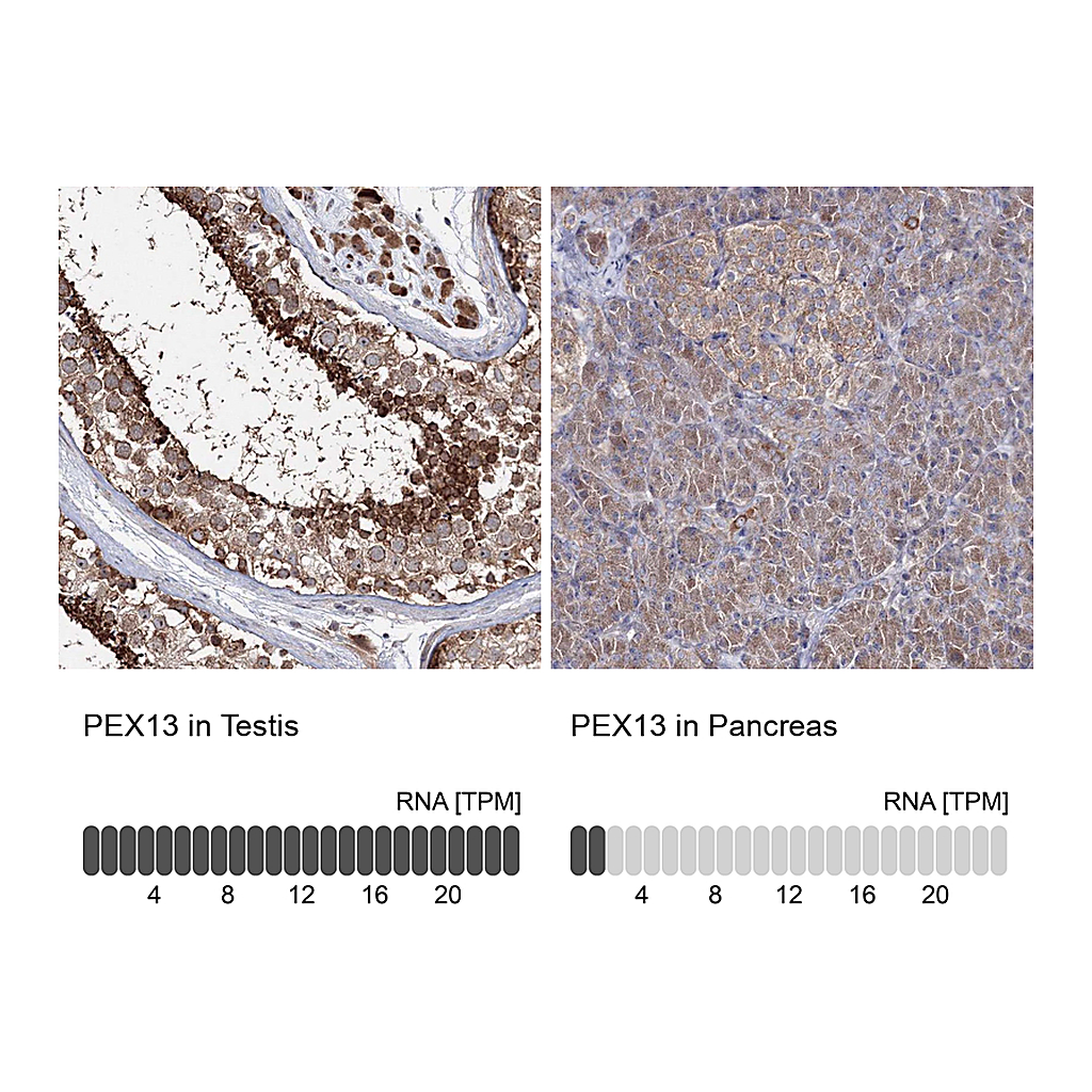 Atlas Antibodies Anti-PEX13 Antibody
