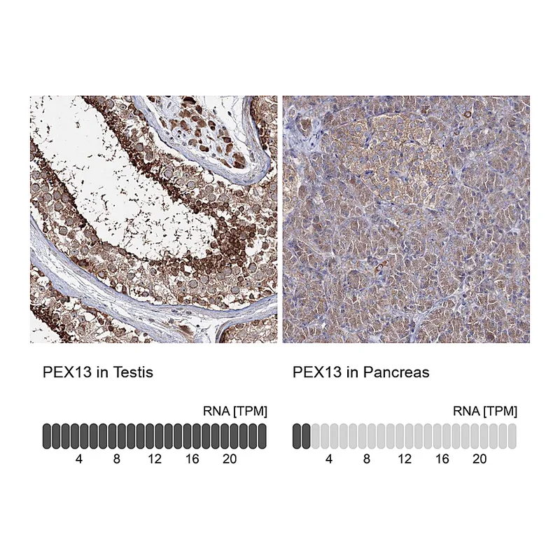 Atlas Antibodies Anti-PEX13 Antibody