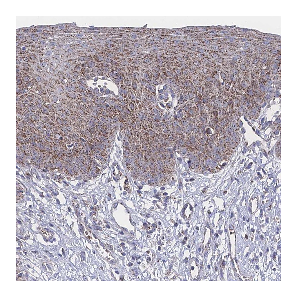 Atlas Antibodies Anti-PEX14 Antibody