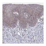 Atlas Antibodies Anti-PEX14 Antibody