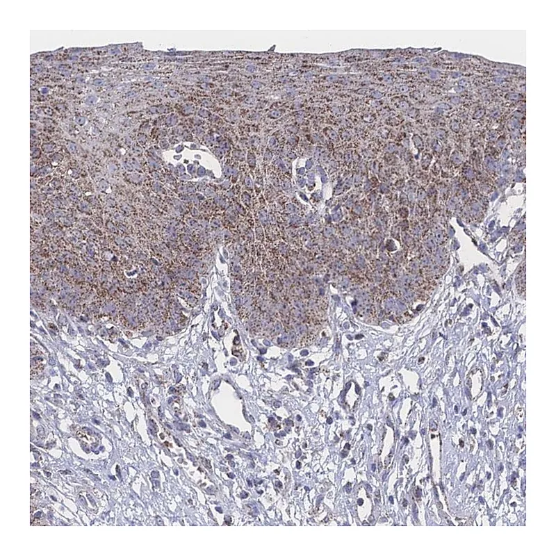 Atlas Antibodies Anti-PEX14 Antibody