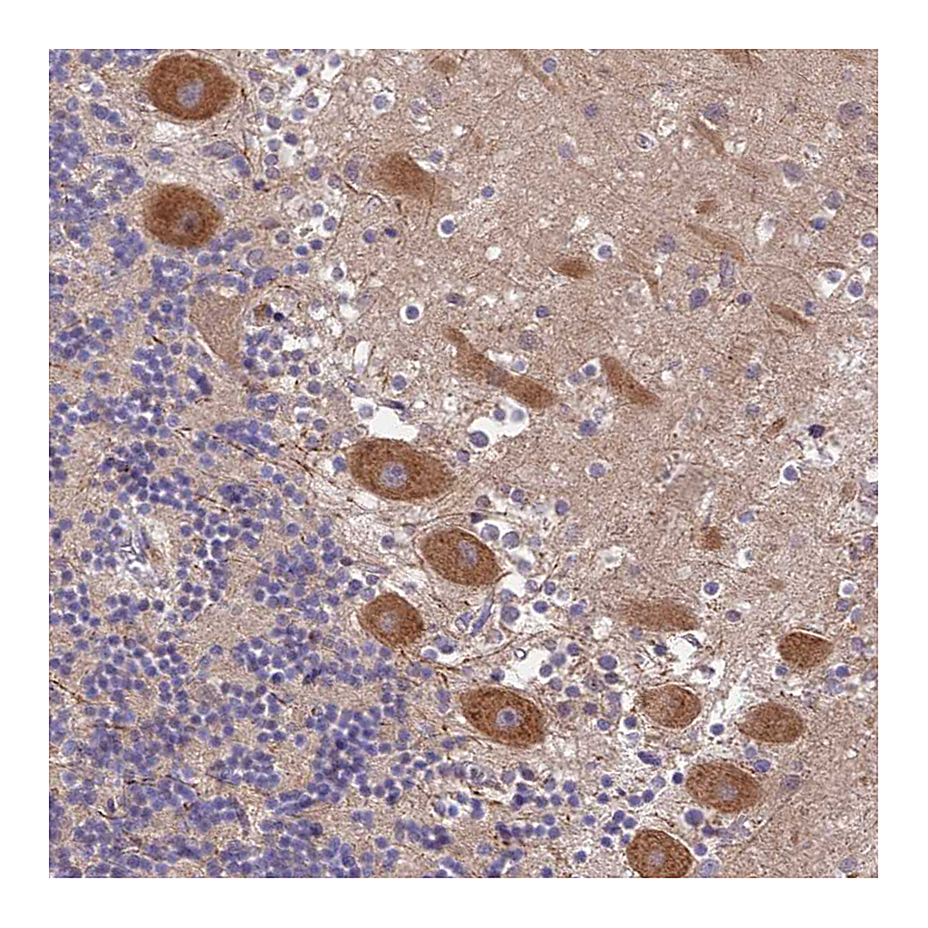 Atlas Antibodies Anti-PEX16 Antibody