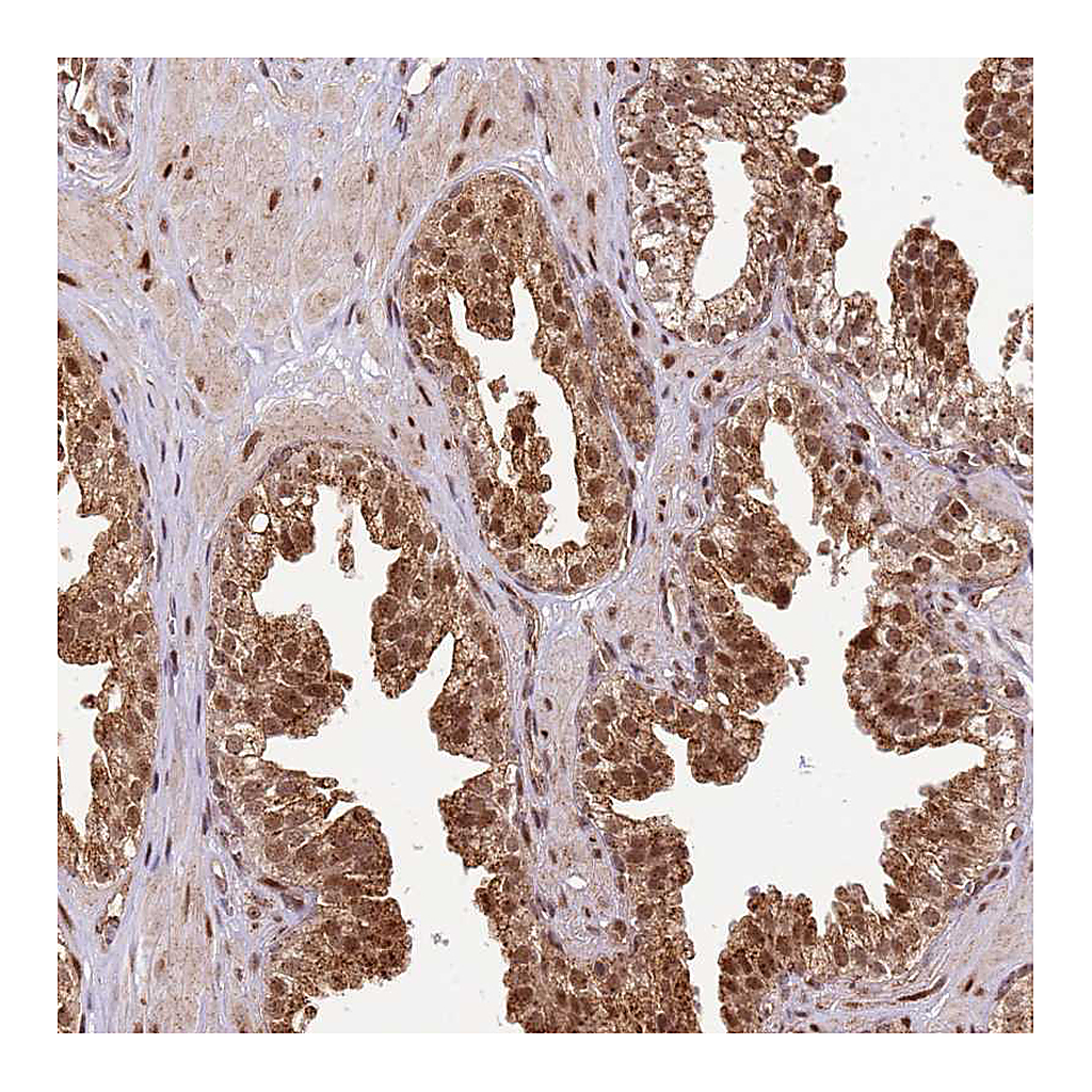 Atlas Antibodies Anti-PEX14 Antibody