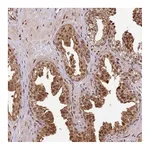 Atlas Antibodies Anti-PEX14 Antibody