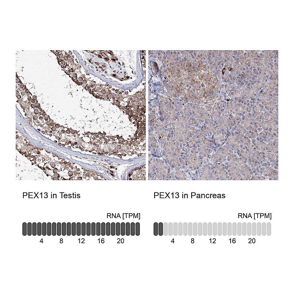Atlas Antibodies Anti-PEX13 Antibody
