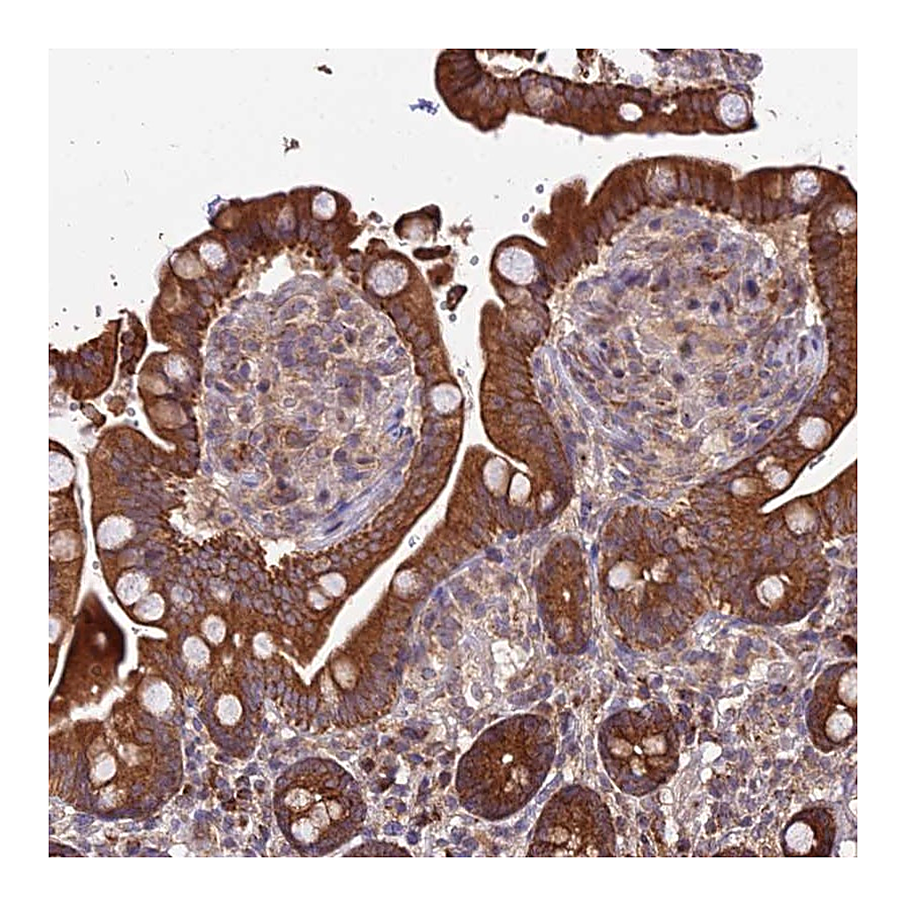 Atlas Antibodies Anti-PEX19 Antibody