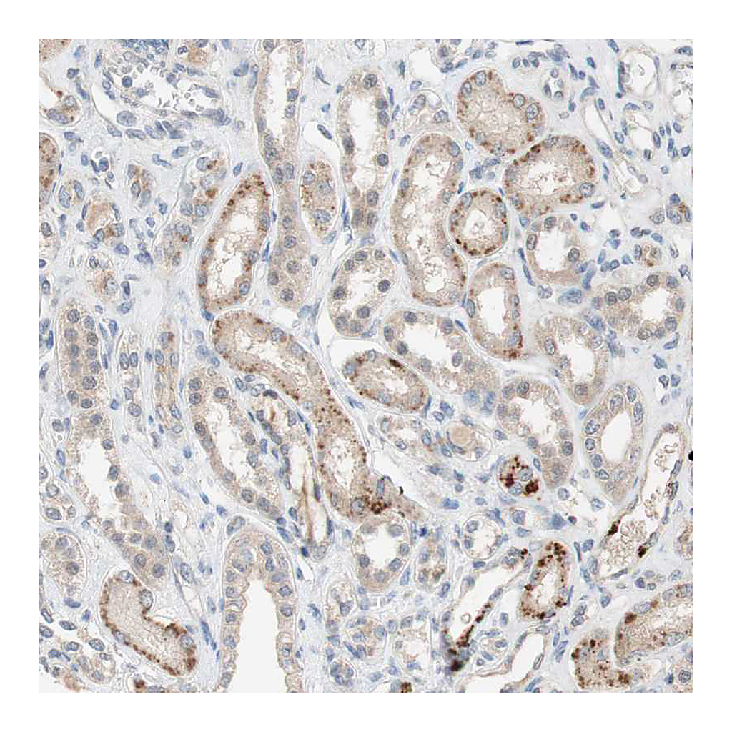 Atlas Antibodies Anti-PEX2 Antibody