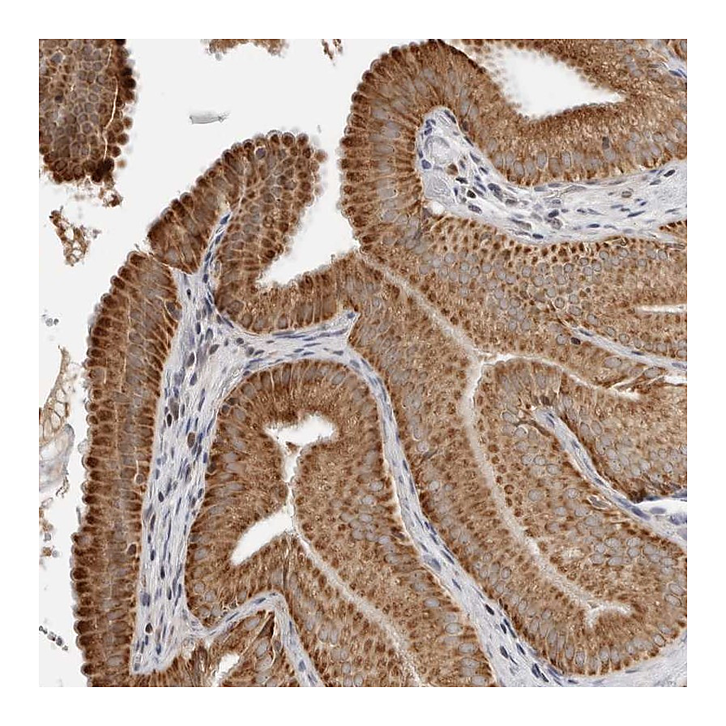 Atlas Antibodies Anti-PEX2 Antibody