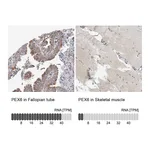 Atlas Antibodies Anti-PEX6 Antibody