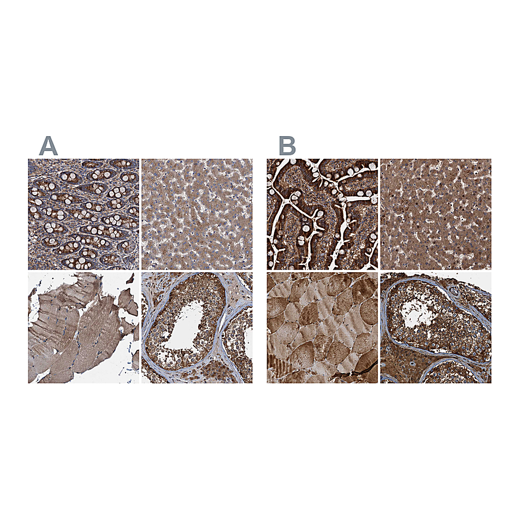Atlas Antibodies Anti-PEX5 Antibody