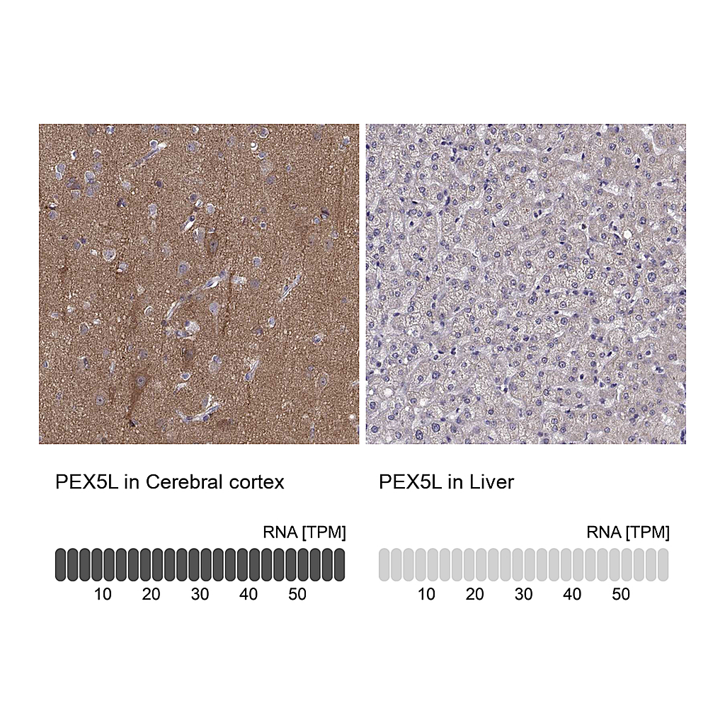 Atlas Antibodies Anti-PEX5L Antibody