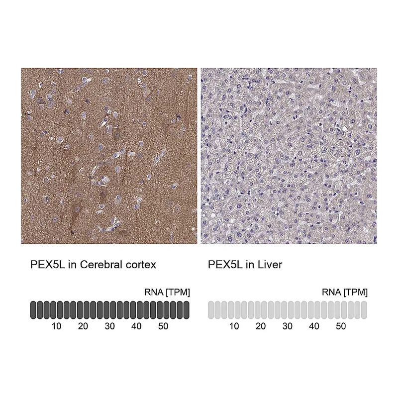 Atlas Antibodies Anti-PEX5L Antibody