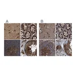 Atlas Antibodies Anti-PEX5 Antibody