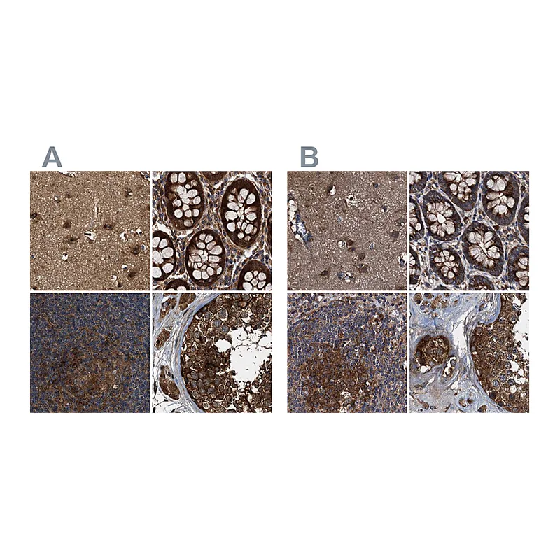 Atlas Antibodies Anti-PEX5 Antibody