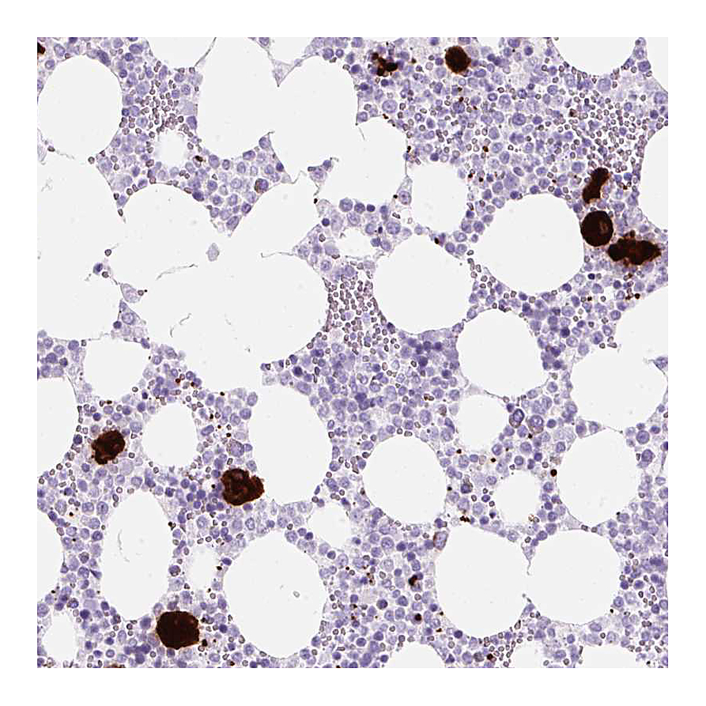 Atlas Antibodies Anti-PF4 Antibody