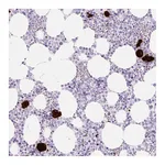 Atlas Antibodies Anti-PF4 Antibody