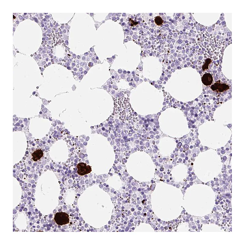 Atlas Antibodies Anti-PF4 Antibody