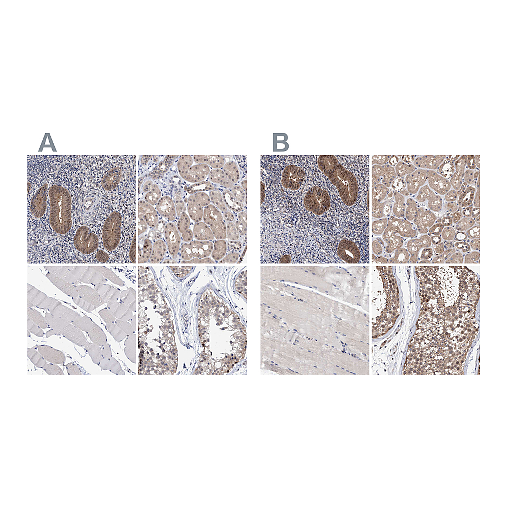 Atlas Antibodies Anti-PFAS Antibody
