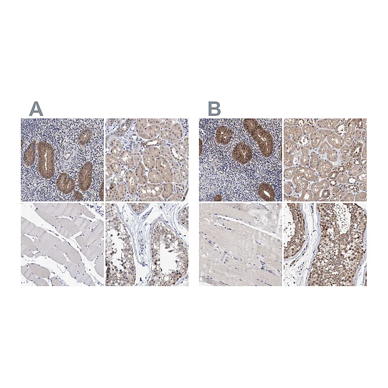 Atlas Antibodies Anti-PFAS Antibody