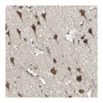 Atlas Antibodies Anti-PFDN1 Antibody
