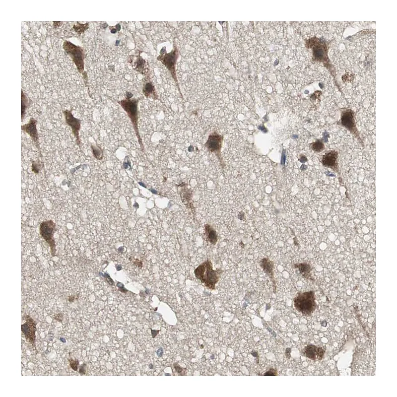 Atlas Antibodies Anti-PFDN1 Antibody
