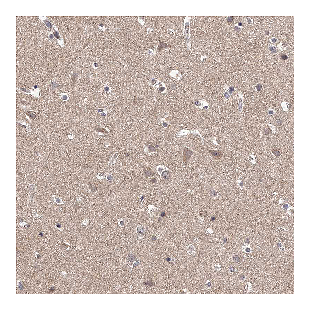 Atlas Antibodies Anti-PFDN2 Antibody