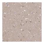 Atlas Antibodies Anti-PFDN2 Antibody