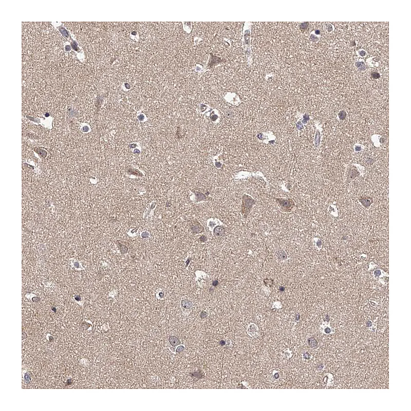Atlas Antibodies Anti-PFDN2 Antibody