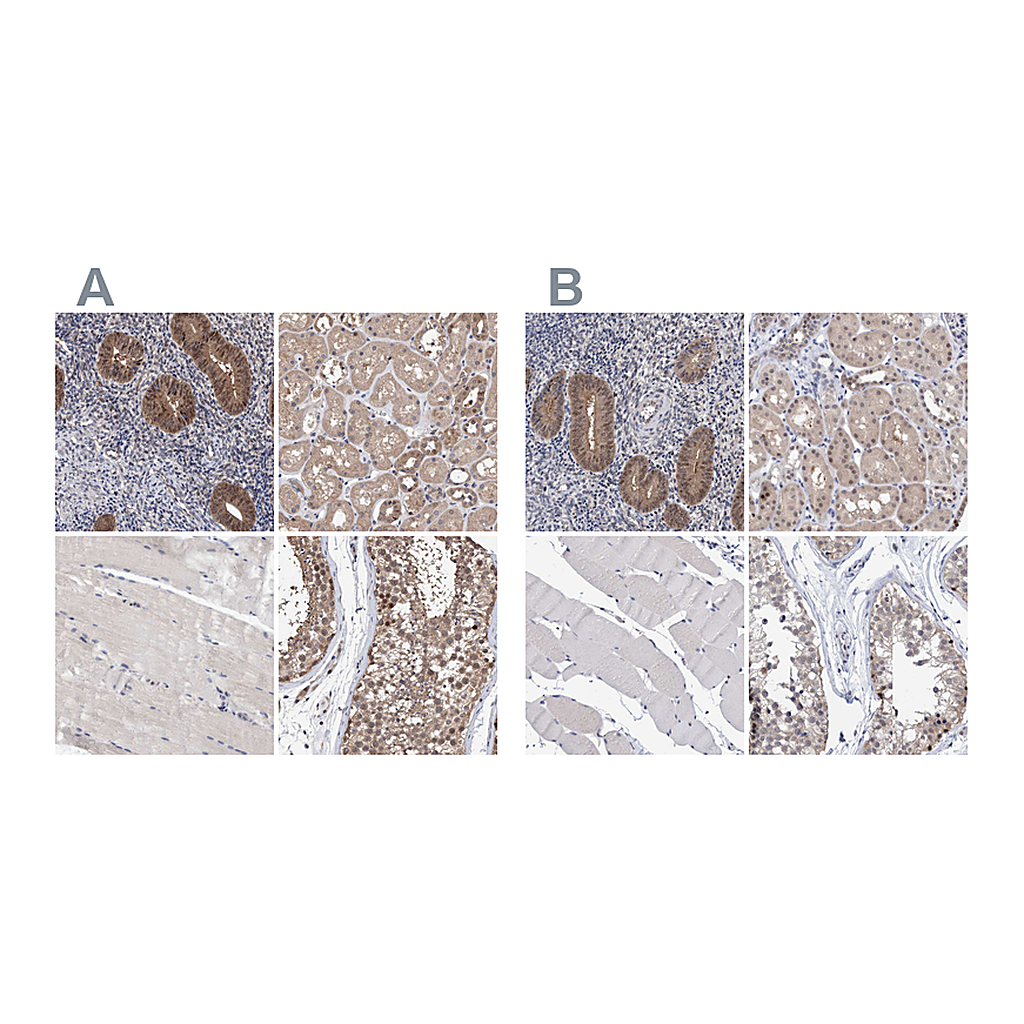 Atlas Antibodies Anti-PFAS Antibody