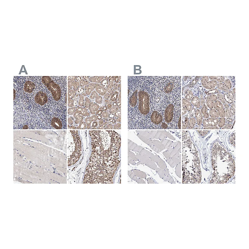 Atlas Antibodies Anti-PFAS Antibody