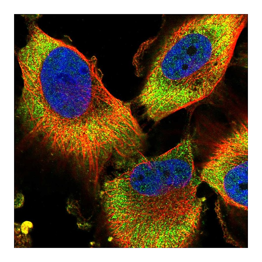 Atlas Antibodies Anti-PFDN2 Antibody
